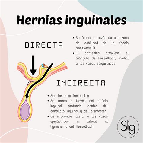 hernia inguinal directa o indirecta